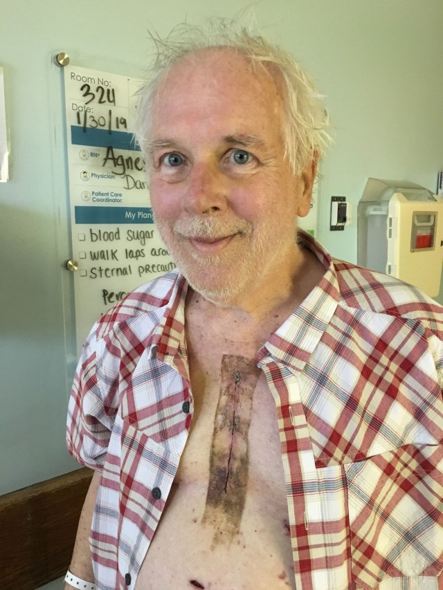 •e-img_6216-scruffy chest