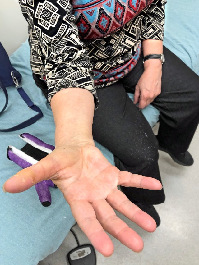 -4843 jlh cast is offCR