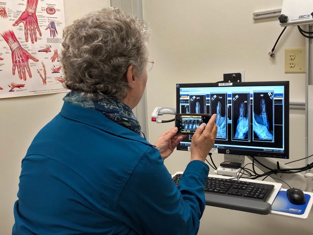 -4848 jlh hand xraysCR