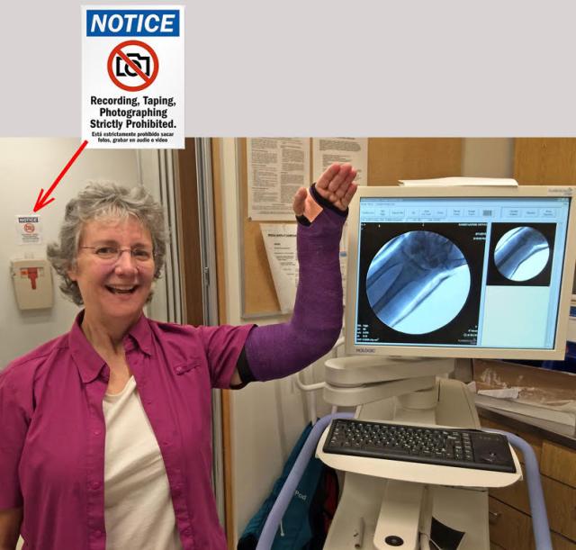 purple wrist cast 2015